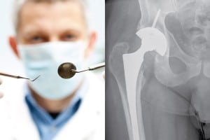 Dental treatment after hip and knee replacement